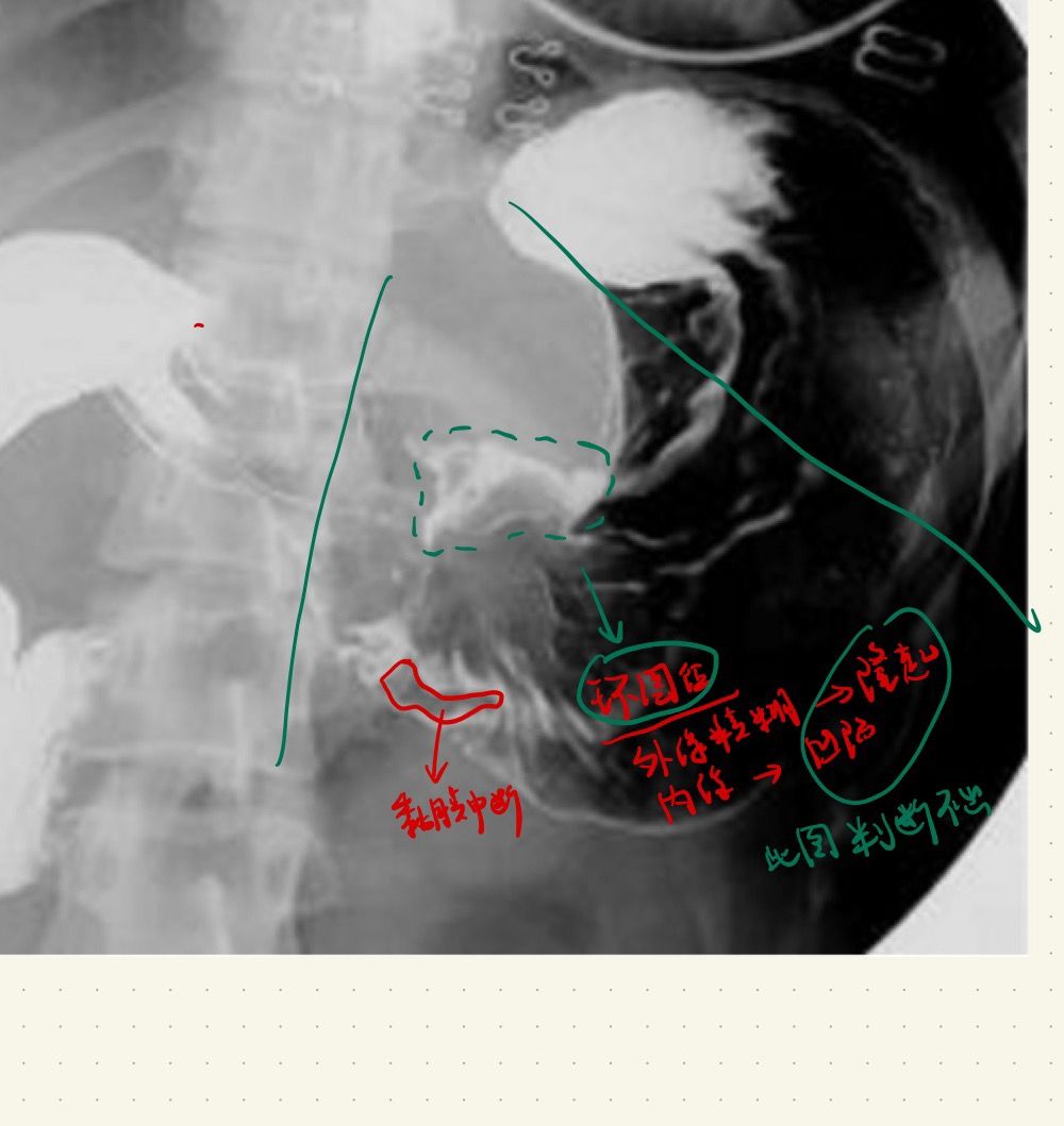 Pasted image 20250316092339.jpg